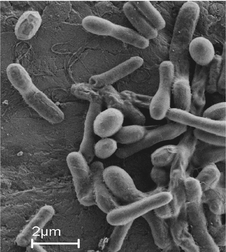 Sporosarcina pasteurii